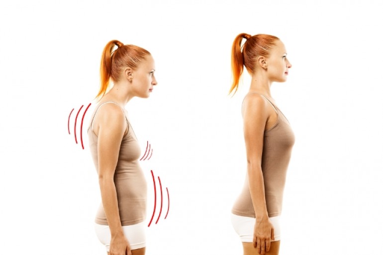 forward head posture